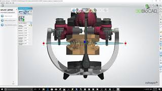 3DBioCAD  Splint Night Guard Guideline [upl. by Ellevel122]