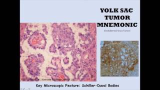 Yolk Sac Mnemonic [upl. by Eade]