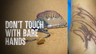 How to Survive a Portuguese Man O War [upl. by Allsopp849]