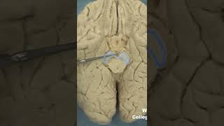 Interpeduncular fossa neuroanatomy brainstembrainWCUCOM Neuroscience [upl. by Airamalegna]