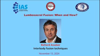 Lumbosacral fusion When and HowInterbody fusion techniques Richard Assaker [upl. by Maddox]