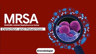 MRSA  All you need to know about methicillin resistant staphylococcus aureus Detection [upl. by Landel]