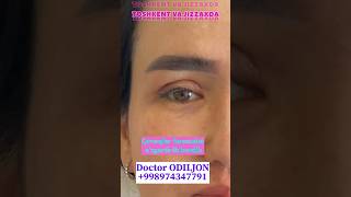 Qovoq olish  қовоқ олиш  blefaroplastika Doctor ODILJON 998974347791 TOSHKENT VA JIZZAXDA rek [upl. by Akit]