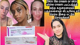 Cure skin shine or skin lite cream’s side effects easily at home 💯 [upl. by Tilly]