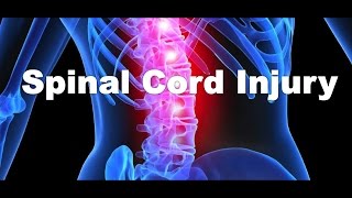 What is a spinal cord injury [upl. by Queena]