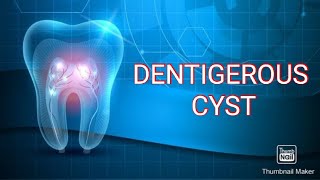 DENTIGEROUS CYST [upl. by Etnoek]