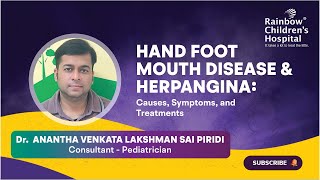 quotHand Foot Mouth Disease amp Herpanginaquot discussed by Dr Anantha Lakshman Consultant Pediatrician [upl. by Sherurd651]