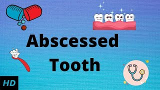 Abscessed tooth Causes SIgns and Symptoms Diagnosis and Treatment [upl. by Yenruoc]