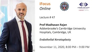 iFocus Online Session 47 Endothelial Keratoplasty by Prof Madhavan Rajan [upl. by Magdalena]