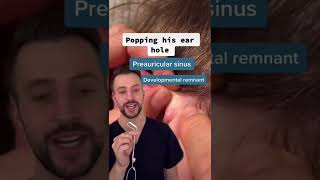 Derm explains preauricular sinus [upl. by Ardien]