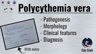 Polycythemia vera  Myeloproliferative Disorders  Pathology [upl. by Afinom49]