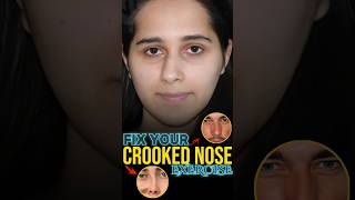 Crooked Nose [upl. by Lennie]