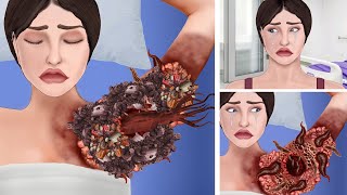 ASMR Remove leeches amp Ticks from infected girl armpit  ASMR Animation Treatment restasmr1 [upl. by Ziguard]