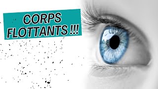 Adieu Corps Flottants Mouches Volantes Points Noirs  4 étapes pour les éliminer  👋👁️ [upl. by Arthur308]