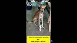 Fracture Treatment Using Linear External Skeletal Fixator [upl. by Bow673]