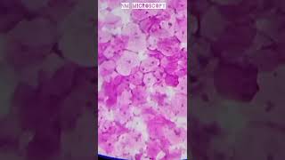 Squamous epithelial cells microscope slide🔬shortvideo youtube [upl. by Onilatac]