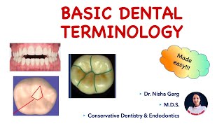 BASIC DENTAL TERMINOLOGY  PART 2  MADE EASY [upl. by Claybourne]