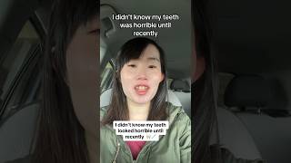 Why This Girl Was BULLIED For Her Teeth 😬🦷 [upl. by Tilla630]