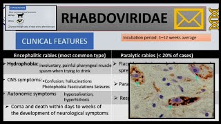 Rabies  cause pathogenesisclinical manifestations diagnosis and prophylaxis [upl. by Wiburg]