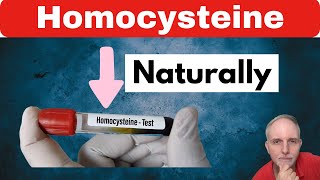 How To Lower Homocysteine Levels Naturallly [upl. by Nierman848]