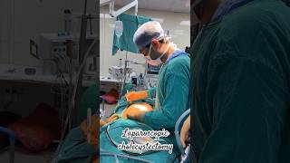 Laparoscopic cholecystectomy  bestsurgeon reels doctor lucknow best neet surgerylife yt [upl. by Aiseneg]