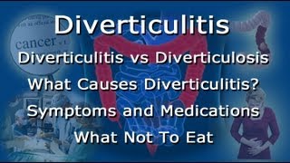 Diverticulitis Vs Diverticulosis  What To Eat What Not To Eat With Diverticulitis [upl. by Eserahs124]