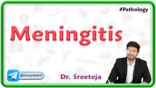 4 Meningitis  USMLE Step 1 Pathology [upl. by Vanessa]