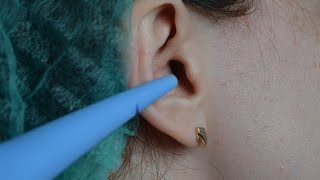 Серная пробка Удаление в домашних условиях Ear wax Removal at home [upl. by Karissa]