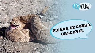 O QUE FAZER APÓS UMA PICADA DE COBRA CASCAVEL [upl. by Avilys]