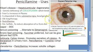 Pharmacology 981 c Chelating Agent Penicillamine Copper Cu wilson disease poisoning kidney cysteine [upl. by Akemej]