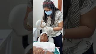 Skin Treatment Melasma amp Pigmentation Chemical Peel [upl. by Rotceh]