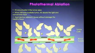 Intratumoral administration of gold nanoshells  Video abstract 30699 [upl. by Yurik]