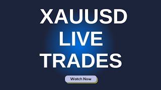 Gold Xauusd Live Trading amp Signals Today  Forex Gold Trading live Stream [upl. by Haodnanehs]