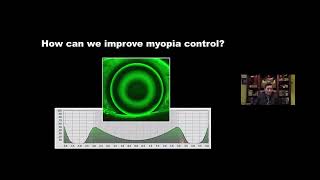 Improving the Myopia Controlling Effect in OrthoK Treatment [upl. by Nhtanhoj]