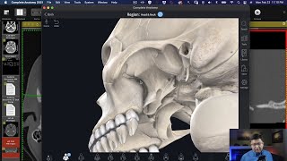 The Ins and Outs of the Pterygopalatince Fossa [upl. by Anitel913]