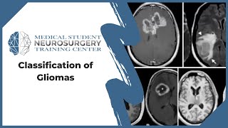 Classification of Gliomas [upl. by Ogren926]