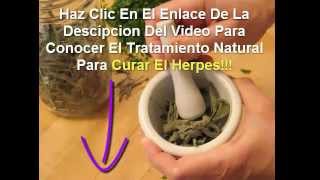 como curar el herpes con remedios caseros [upl. by Stevy]