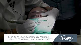 Microabrasión y remineralización dental con la Dra Rocío Lazo [upl. by Sayer]