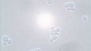 Budding and Shmooing  Yeast Reproduction [upl. by Euqram123]