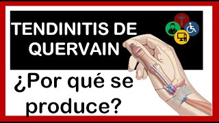 Tendinitis de quervain ¿Cual es el TRATAMIENTO [upl. by Andreas738]