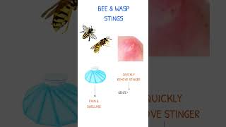 BEE amp WASP STINGS NURSING CARE [upl. by Ehtyaf]