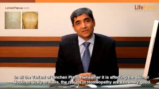 Lichen Planus and its homeopathic treatment explained by Dr Rajesh Shah MD [upl. by Incrocci]