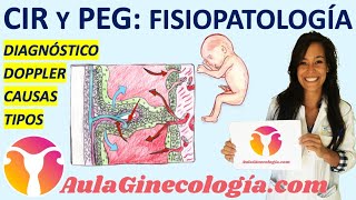 CIR y PEG FISIOPATOLOGÍA 🚼 CRECIMIENTO INTRAURTERINO👶🏼 RESTRINGIDO  Ginecología y Obstetricia [upl. by Tadeo]