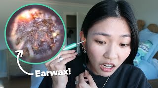 We Used An Earwax Cleaning Camera For The First Time [upl. by Ardnoik]