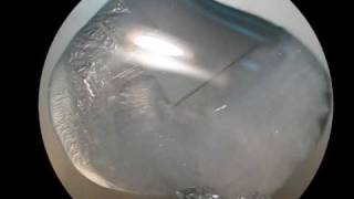 Growing Sodium Thiosulfate Crystals [upl. by Zigmund535]