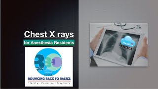 Chest X rays  for Anesthesia Residents AnesthesiaTOOLS saneeshpj [upl. by Cassondra288]