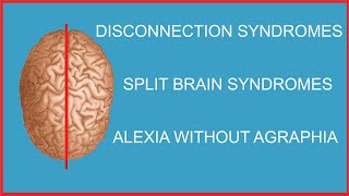 DISCONNECTION SYNDROMESSPLIT BRAIN SYNDROMESALEXIA WITHOUT AGRAPHIA [upl. by Natasha171]