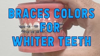 Braces colors for WHITER teeth [upl. by Bush]