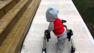 Jakob Walking with walker arthrogryposis [upl. by Stinky]