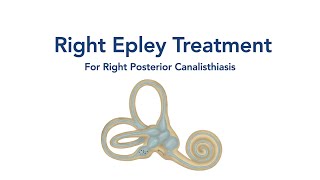 At Home Right Epley Maneuver for BPPV Vertigo [upl. by Ainslie800]